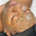 Peeling du Visage